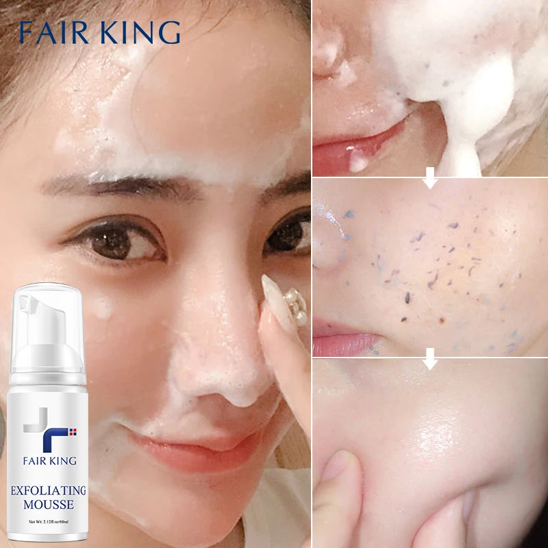 FAIR KING Facial Exfoliating Mousse Facial Cleanser Exfoliator For Face Scrub