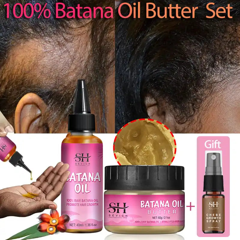 Batana Baldness Oil 100% Pure Natural Hair Growth Essence Butter  Hair Loss Treatment