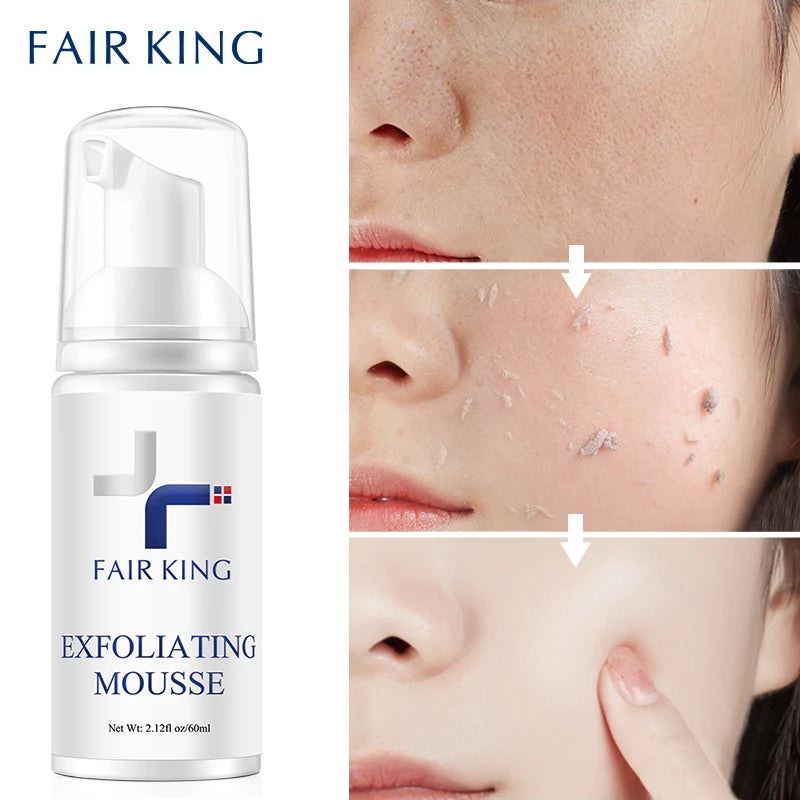 FAIR KING Facial Exfoliating Mousse Facial Cleanser Exfoliator For Face Scrub