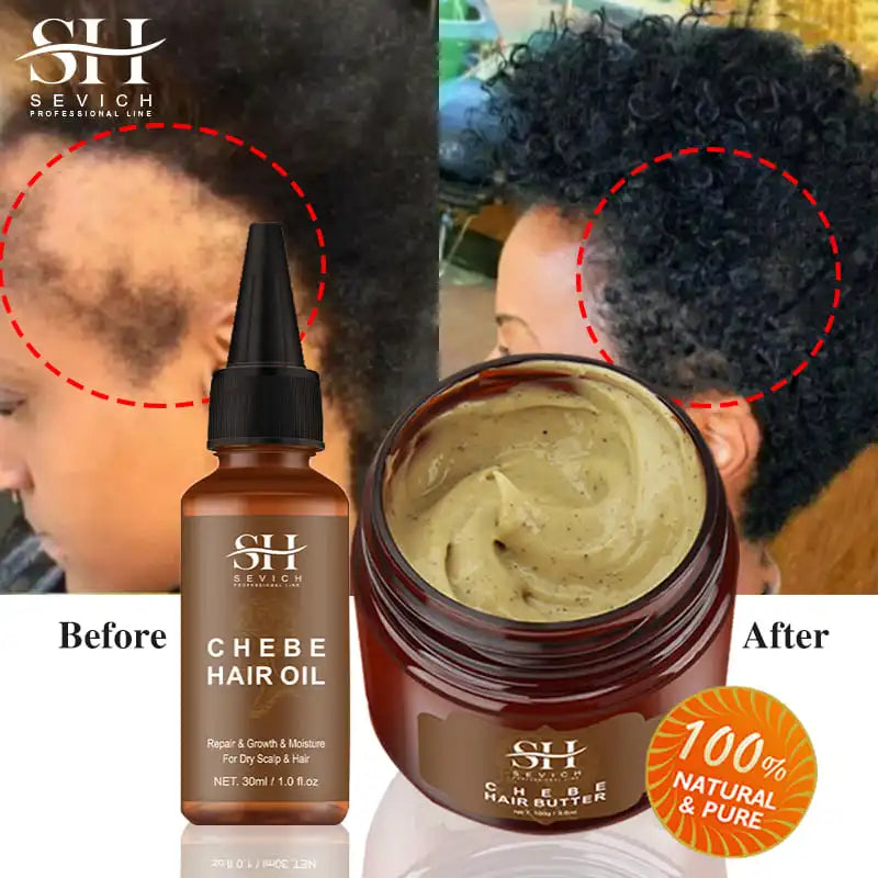 Africa Traction Alopecia Hair Growth Oil 100g Anti-break Moisturize Hair Mask