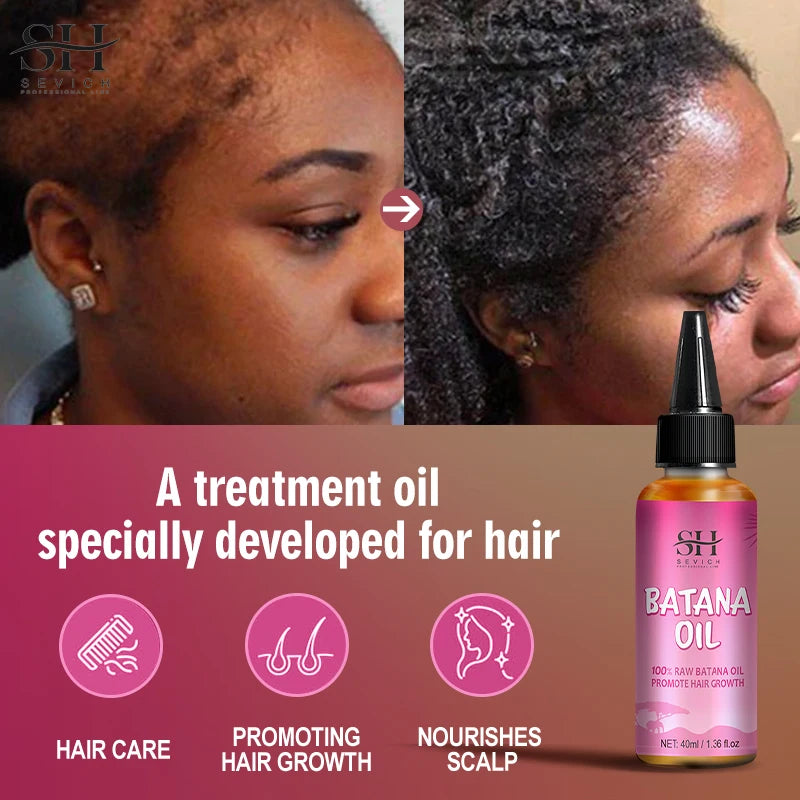 100% Batana Hair Fast Growth Oil Set African Crazy Traction Alopecia Batana Hair Mask