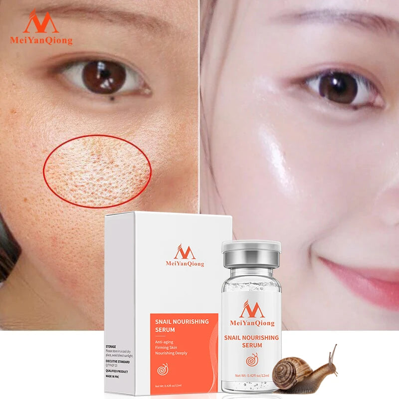 Snail Serum Face Moisturizing Solution Whitening Anti Aging Anti Wrinkle Acne