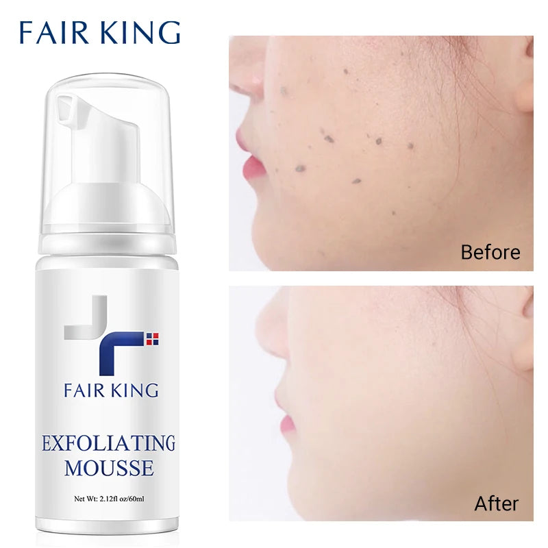 FAIR KING Facial Exfoliating Mousse Facial Cleanser Exfoliator For Face Scrub