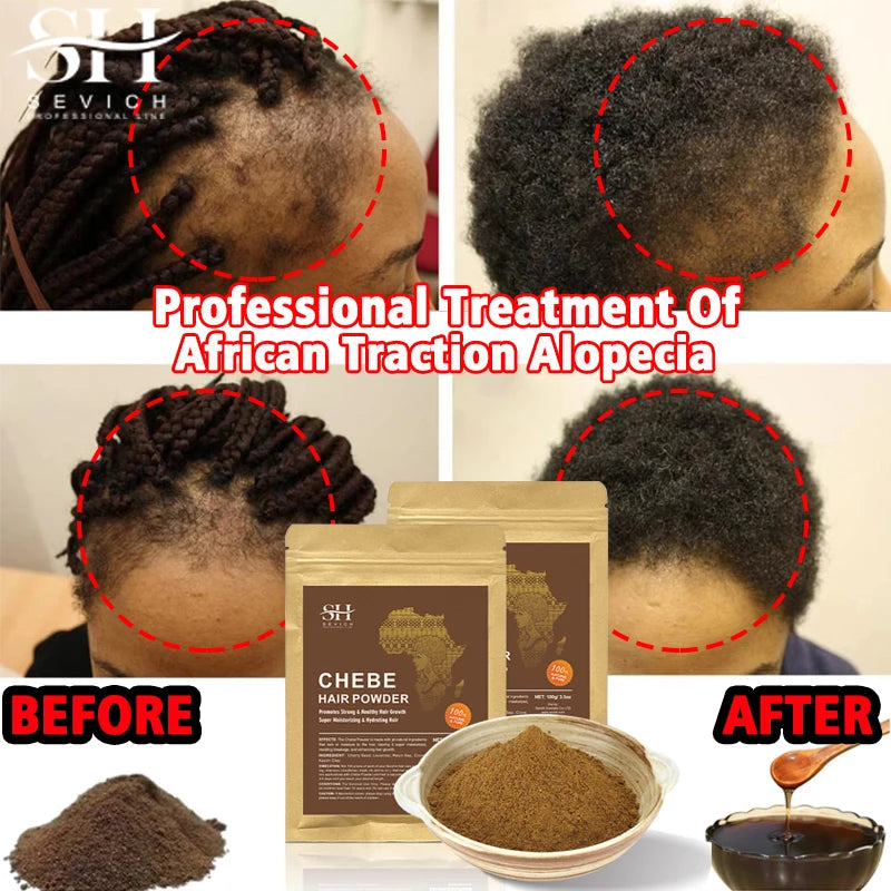 100g Chebe Powder Africa Women Traction Alopecia Treatment Oil Men Hair Growth Spray