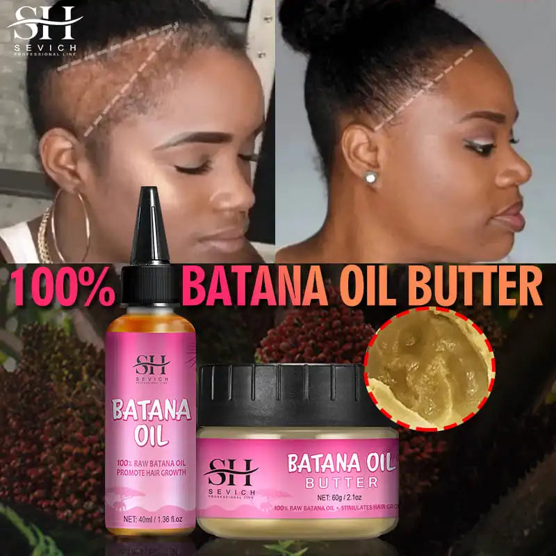 Batana Baldness Oil 100% Pure Natural Hair Growth Essence Butter  Hair Loss Treatment